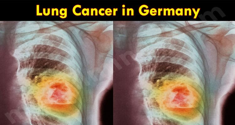 Complete Information Lung Cancer in Germany