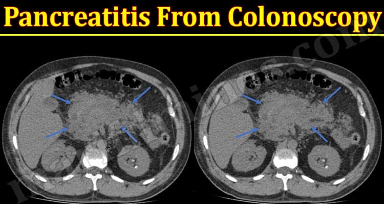 Latest News Pancreatitis From Colonoscopy